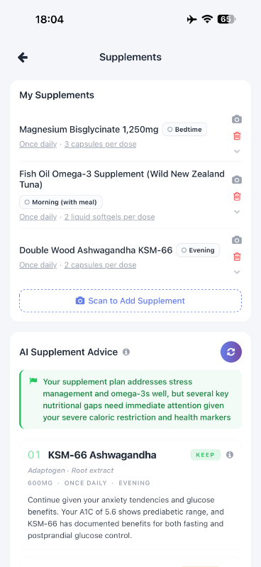 Supplement intelligence